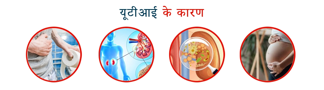 Causes of Urine Infection in Hindi